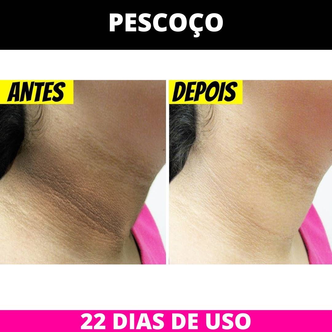 Antes e Depois - Axila